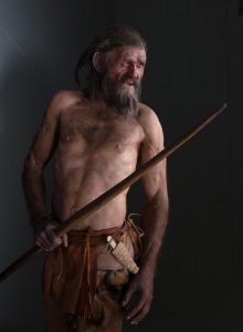 Otzi the Iceman had Lyme Disease and Whipworm and was found with Tinder and Birch Polypores